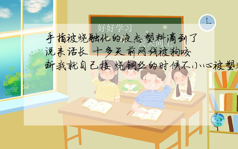 手指被烧融化的液态塑料滴到了说来话长 十多天前网线被狗咬断我就自己接 烧铜丝的时候不小心被塑料滴到指头 当时挺疼的就没管 现在 皮肤下有血块了 上面有层透明的 摸上去有点硬 我